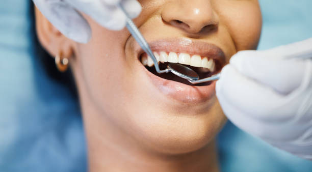 Best Emergency Wisdom Tooth Extraction in East Helena, MT